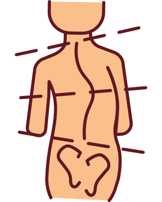 Scoliosis